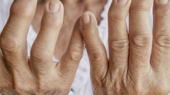 Imagem de Duas irmãs, dois sistema de saúde